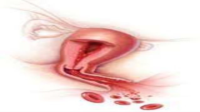 bleeding picture vagina Bleeding picture vagina